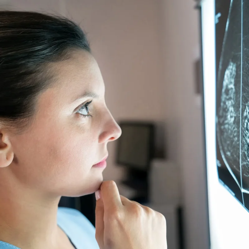 dense breast tissue can hide cancer now what 6849c02833c07