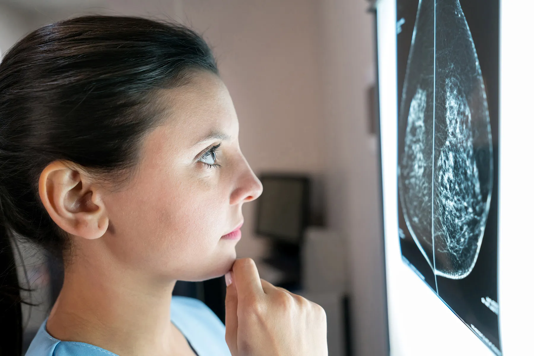 Țesutul mamar dens poate ascunde cancerul. Ce urmează?