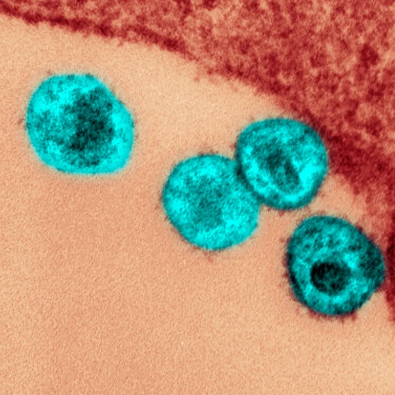 fda approves first twice yearly shot to prevent hiv 68544c28b077c