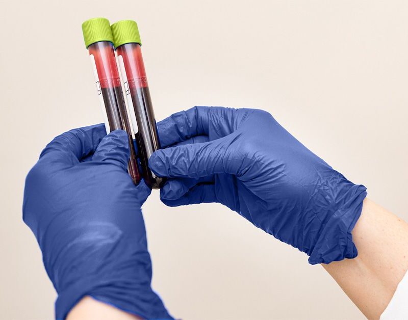 novel blood test could diagnose celiac disease without triggering symptoms 684d0be76b5a5