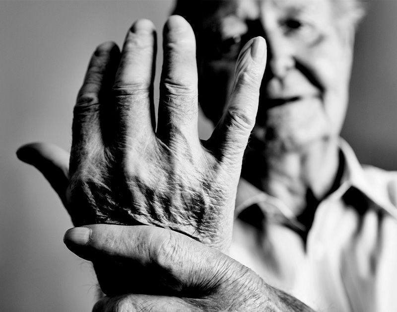 clinical test may predict best rheumatoid arthritis biologic for each individual 686e47b7bdcca