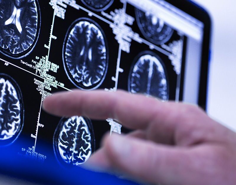 could a single brain scan predict the risk of age related conditions like dementia 686820b6ce657