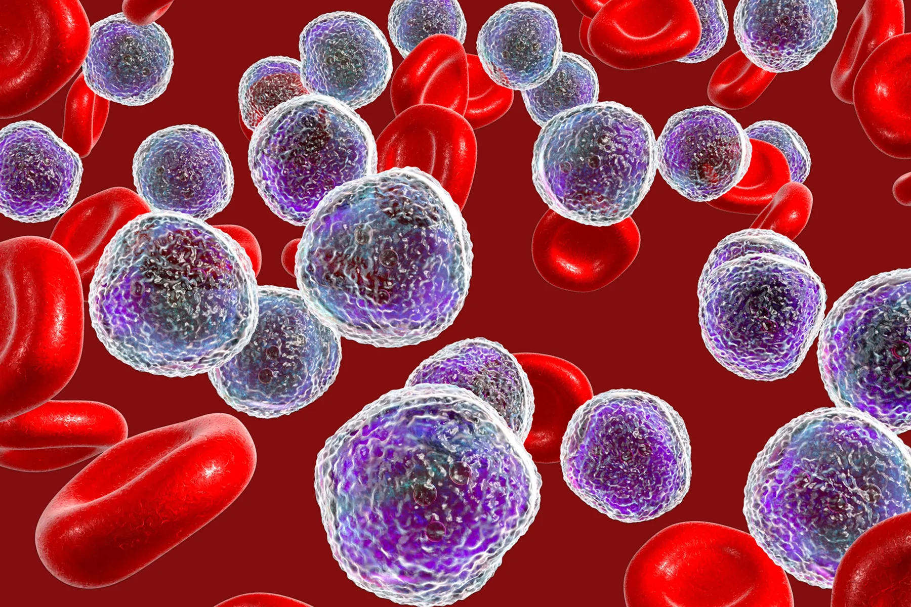 Punctul Orb al Verii: Cancerul de Piele Letal Pe Care Îl Ignorăm