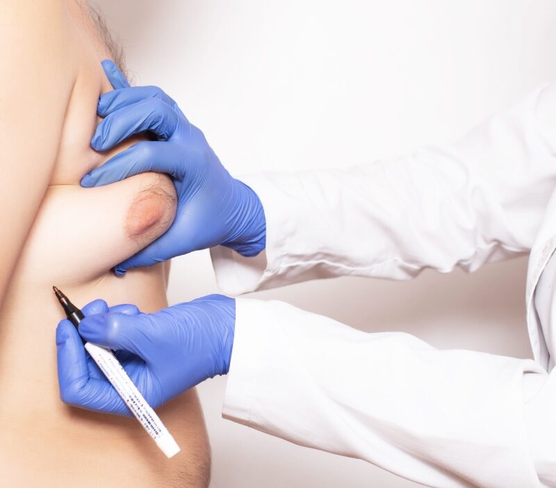 si barbatii pot face cancer de san care sunt simptomele si factorii de risc 68ff92637e925