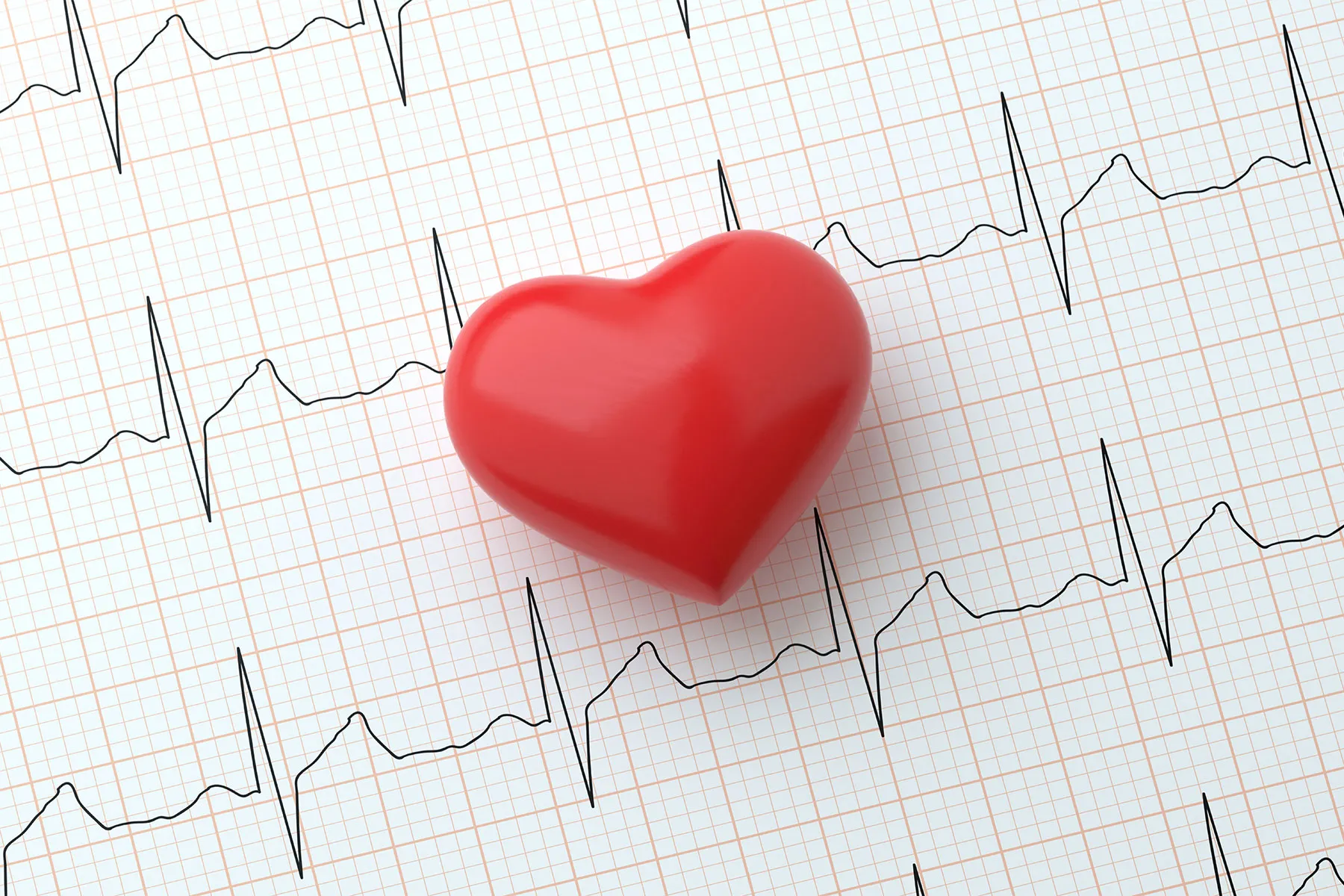 3 Descoperiri inedite despre fibrilația atrială și impactul ei