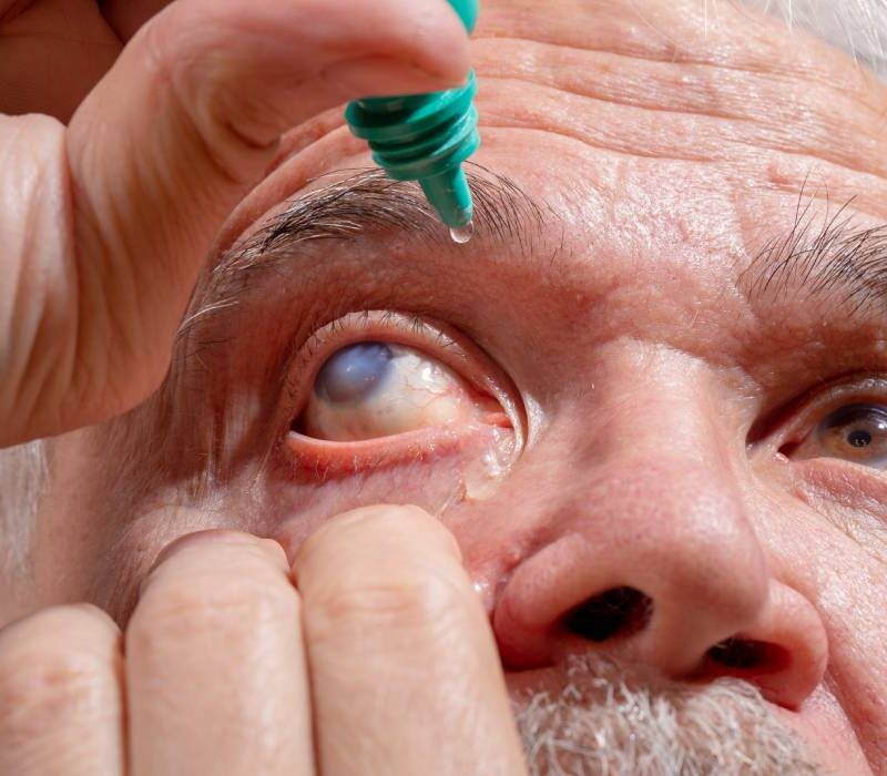 cataracta tratata cu laser femtosecunde ce trebuie sa stii despre interventie 6921992c8bcfb