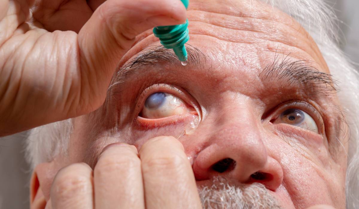 Cataracta și soluția laser femtosecundă: informații esențiale despre procedură