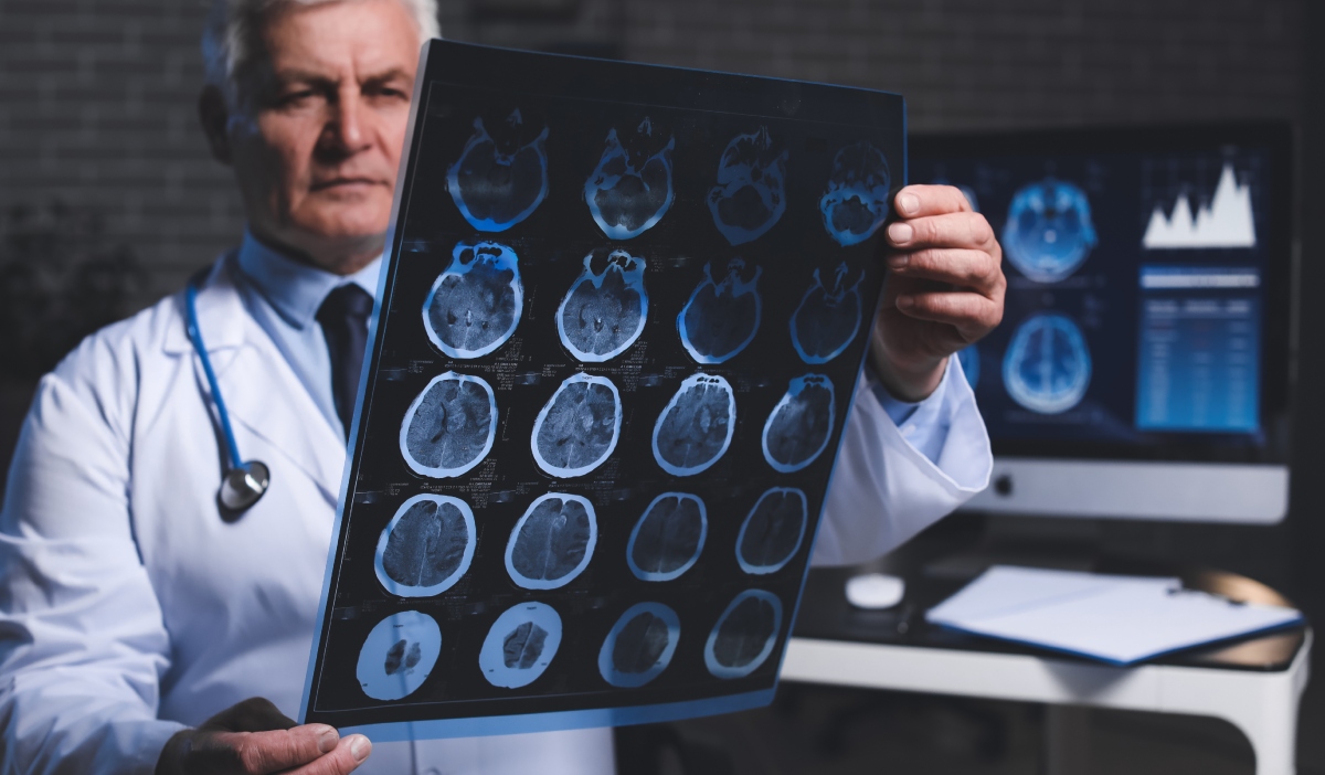 Semnul discret al demenței: prima manifestare nu este uitarea