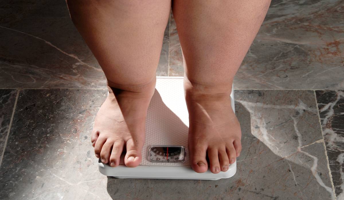 Când regimurile nu dau rezultate: semnele care îți indică necesitatea unei intervenții medicale în lupta împotriva obezității