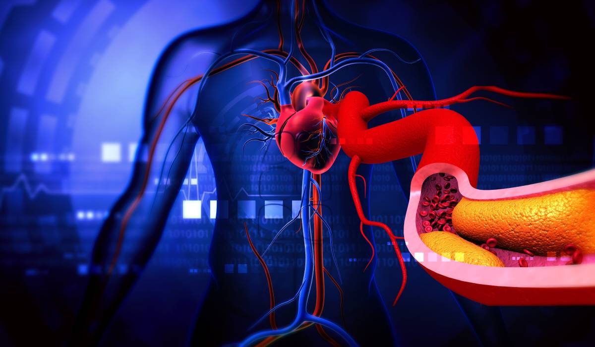 Colesterolul crescut: tăcutul dușman al inimii – Ghidul AHA pentru menținerea sănătății cardiovasculare