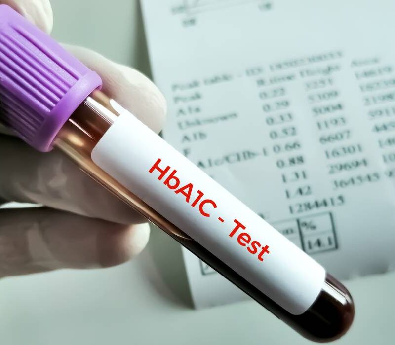 de ce poate creste hemoglobina glicata hba1c glicemia ridicata nu este singura explicatie 6a5ccc2a56843