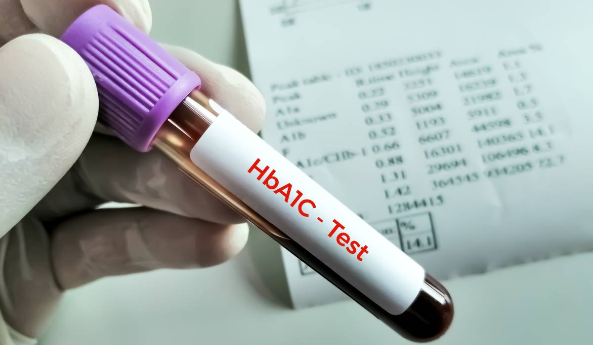 Ce factori contribuie la creșterea hemoglobinei glicată (HbA1c)? Glicemia crescută nu este singura cauză