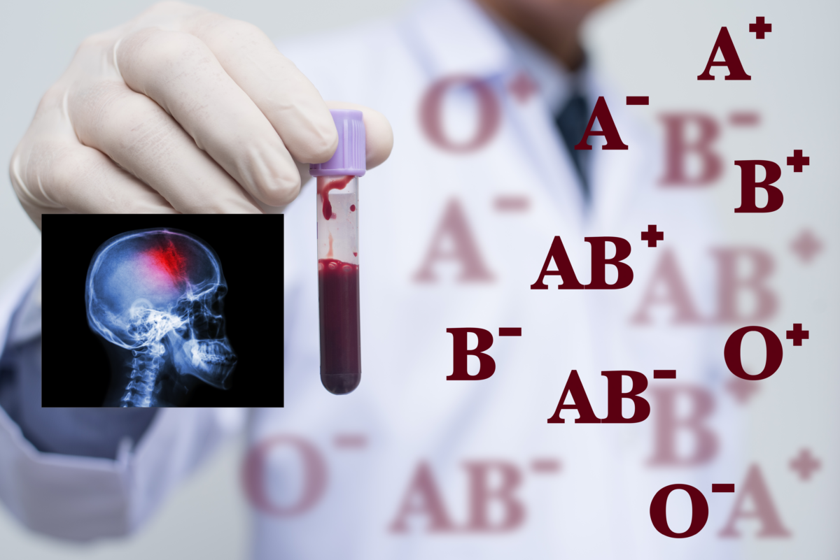 Grupa de sânge asociată cu un risc crescut de accident vascular cerebral înainte de vârsta de 60 de ani: descoperirile savanților
