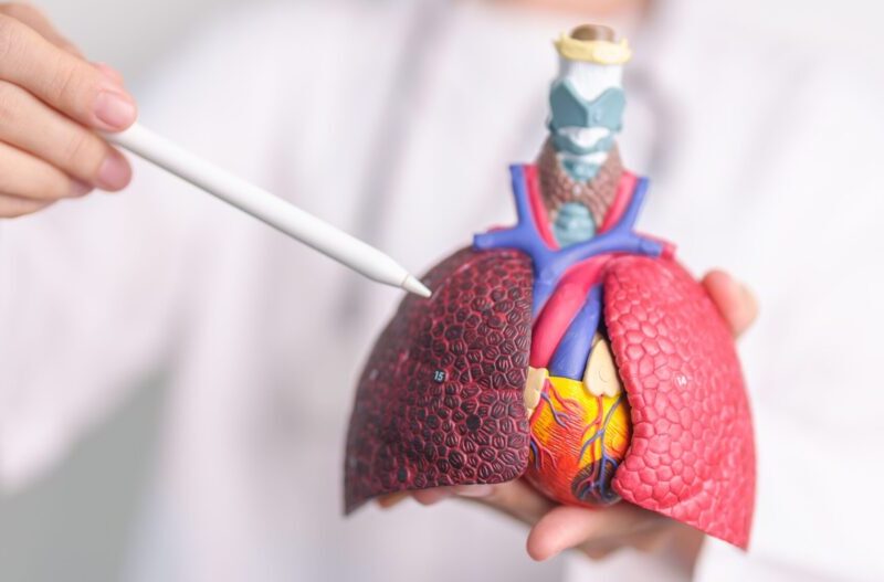 cancerul pulmonar nu afecteaza doar fumatorii medicul explica factorii de risc pe care multi ii ignora 6a744dc847503