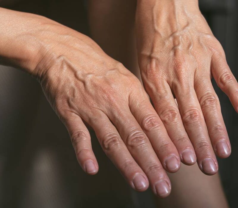 corpul nu imbatraneste treptat ci in salturi varstele la care apar cele mai importante schimbari 6a916ae95c6e2