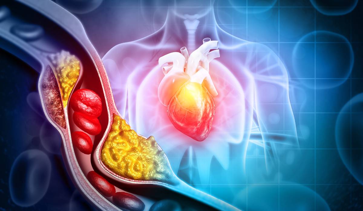 Poți suferi un infarct chiar și cu colesterol în limite normale? Părerea medicilor despre riscurile neidentificate în analizele de rutină