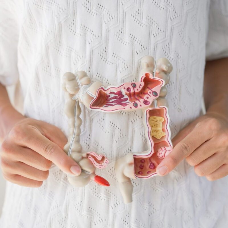 Microbiomul intestinal: o lume „contagioasă” în care bacteriile circulă între oameni 2 microbiomul intestinal ar putea fi contagios bacteriile din intestin se pot transmite intre oameni 6aa3cbfdc6138